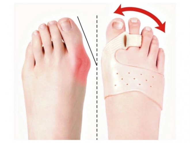Odvajač prstiju na nogama za haluks valgus s magnetom